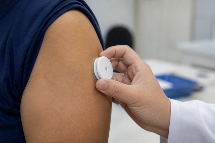 Palmas começa a distribuir sensor de glicose pelo SUS, primeira da Região Norte