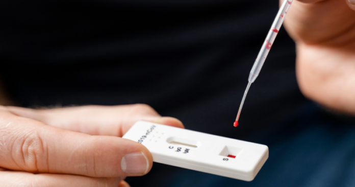 Paranavaí oferece testes rápidos gratuitos para HIV, sífilis e hepatites B e C
