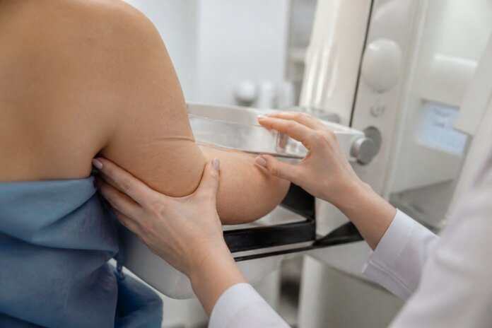 Umuarama: Uopeccan oferece mamografia gratuita para mulheres a partir dos 40 anos