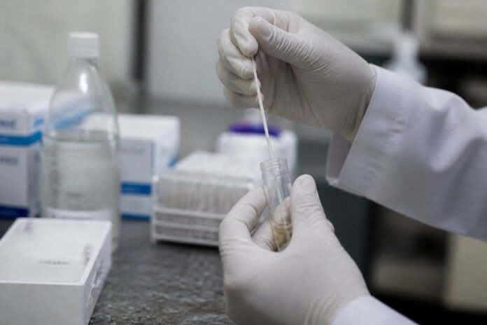 Cascavel amplia teste de HPV nas unidades de saúde