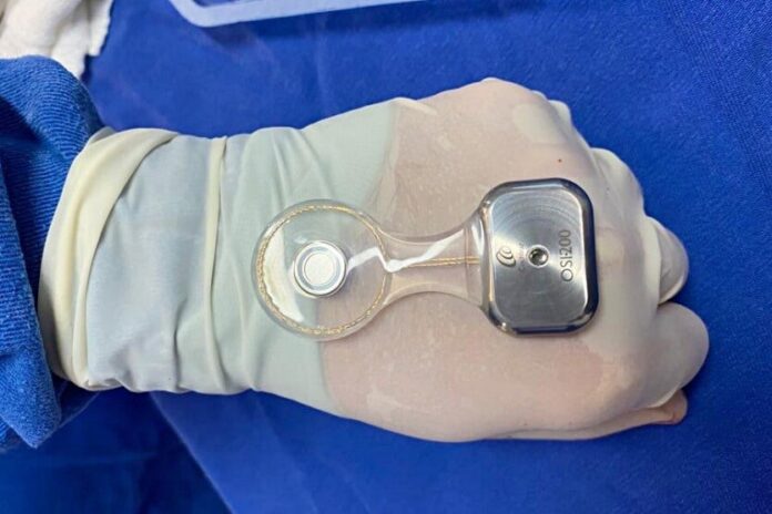 Umuarama amplia tratamento de surdez com implantes cocleares na Uopeccan